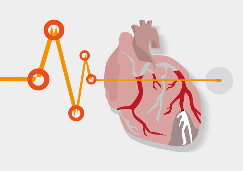 پیش بینی احتمال بروز بیماری قلبی با کمک هوش مصنوعی