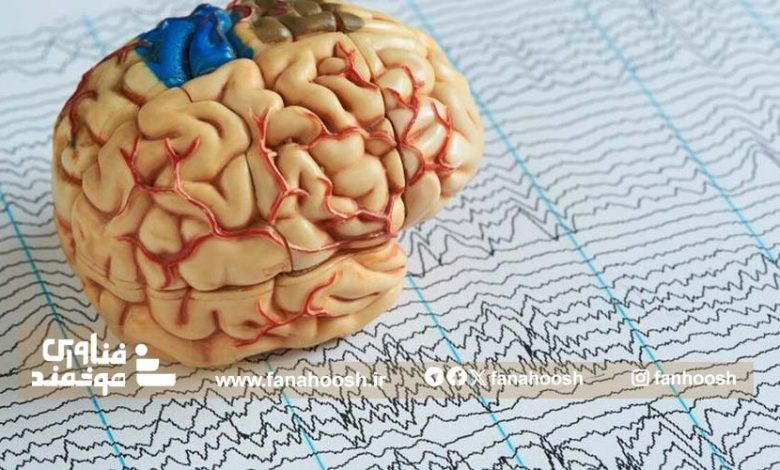 هوش مصنوعی الگوهای پنهان مغز را کشف می کند